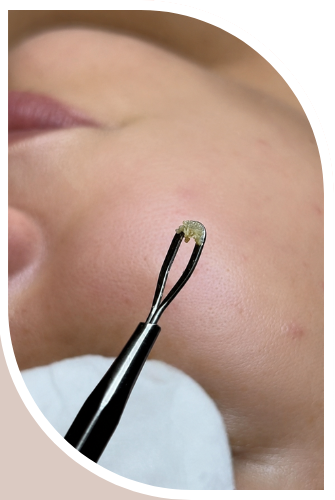 higiene profunda facial